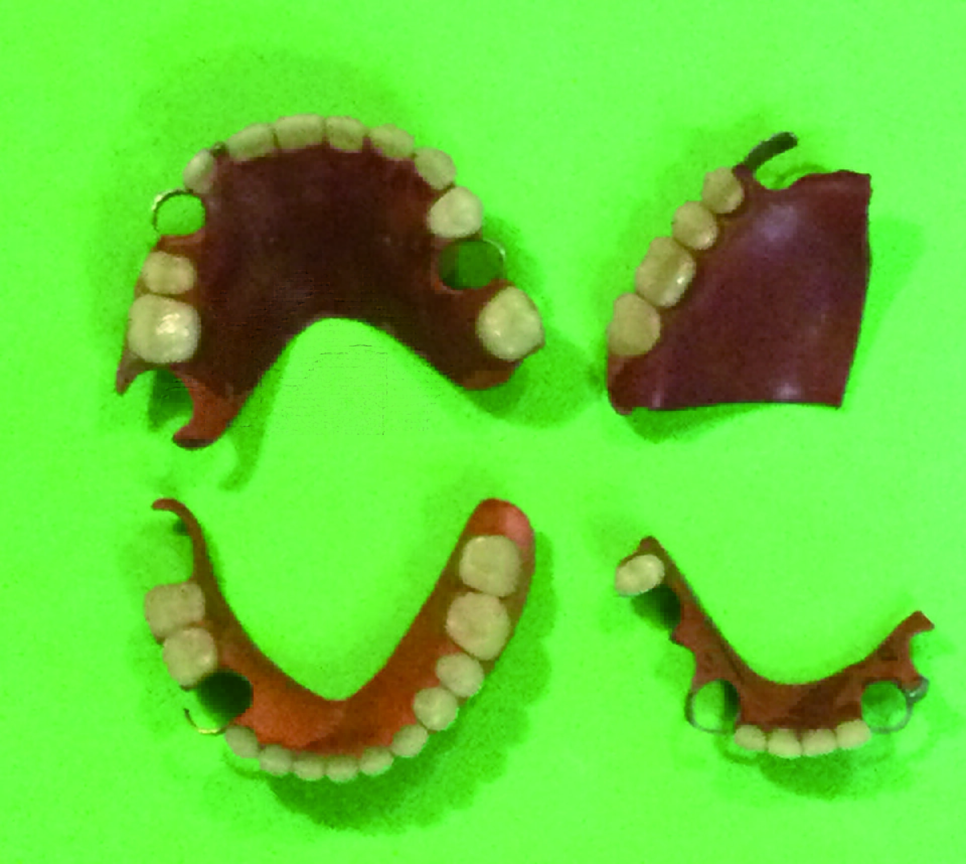 図10a　クラスプ有りゴム床義歯