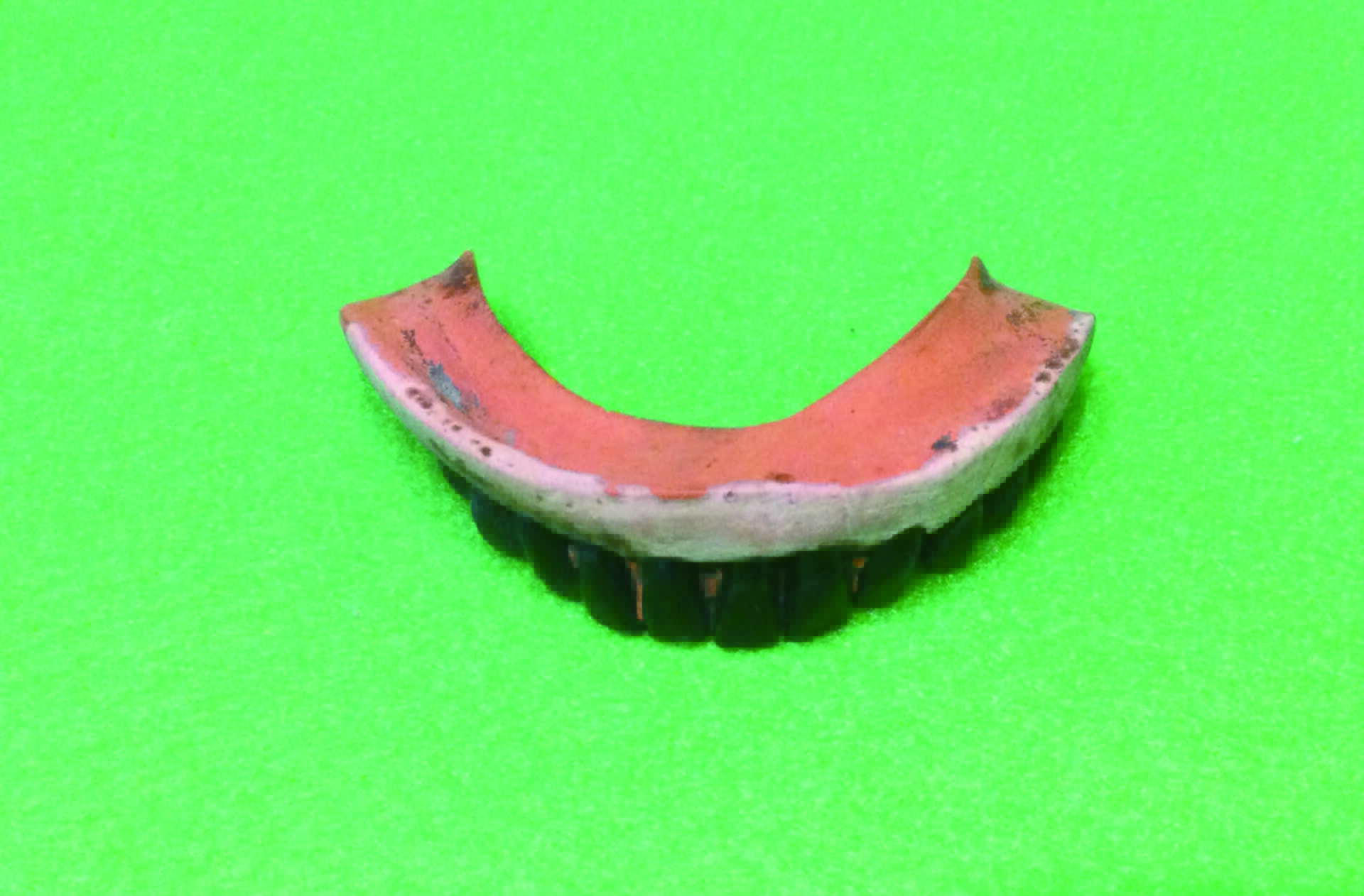 図４c　お歯黒陶歯のゴム床義歯床内面