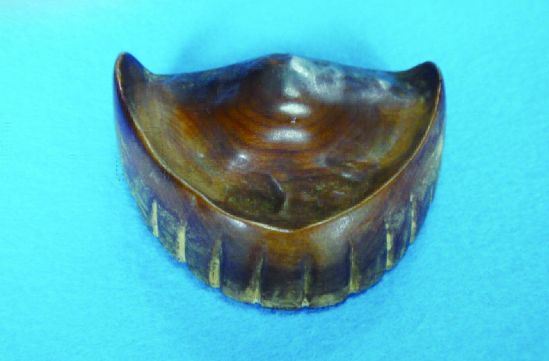 図１a　世界最古の総義歯（願成寺）