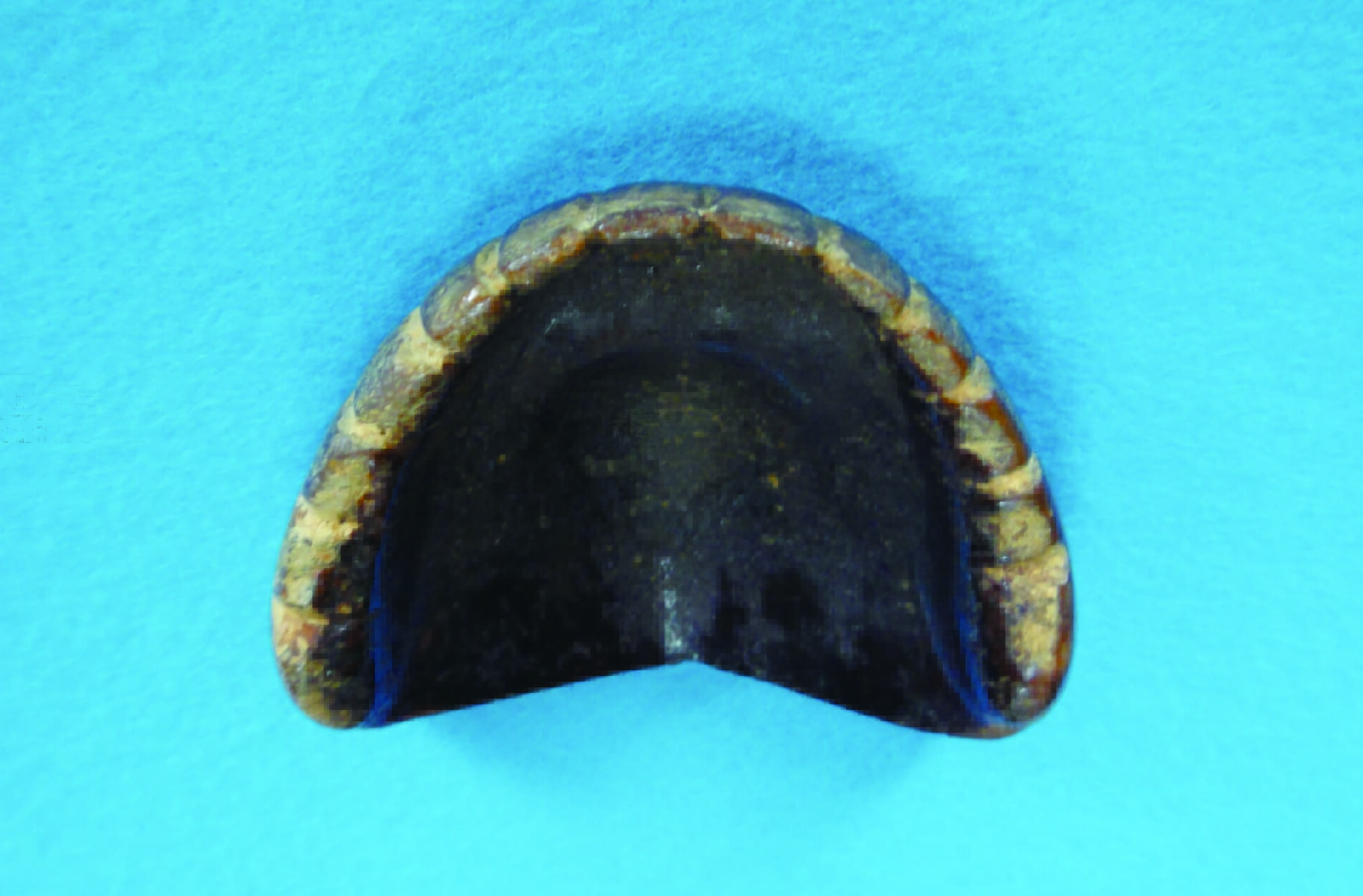 図１b　世界最古の総義歯咬合面